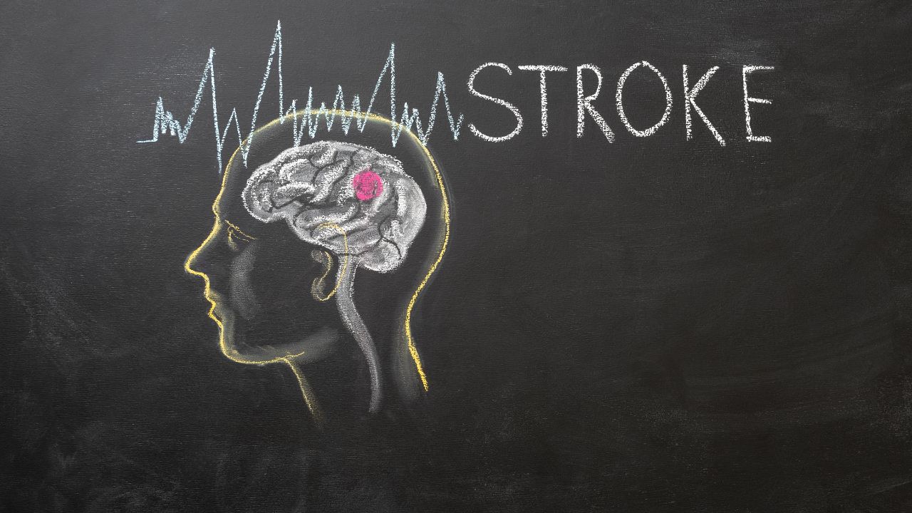 Why Does a Brain Stroke Occur?